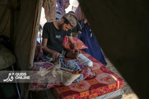 تصاویری از تلاش فلسطینیان قطع عضو شده در بمباران اسرائیل برای ادامه زندگی