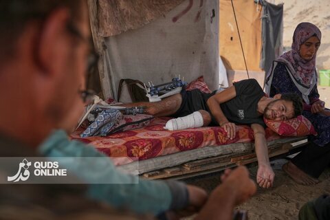 تصاویری از تلاش فلسطینیان قطع عضو شده در بمباران اسرائیل برای ادامه زندگی