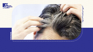 فیلم | باور غلط راجع به سفیدشدن موها