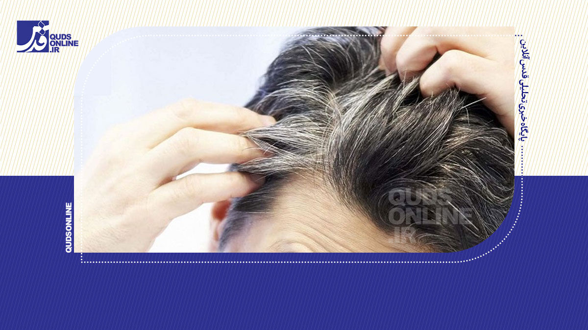 فیلم | باور غلط راجع به سفیدشدن موها