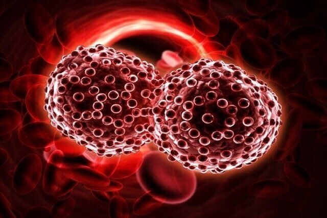 سرطان‌های حاد خون با علائم شدید و سریع بروز می‌کنند