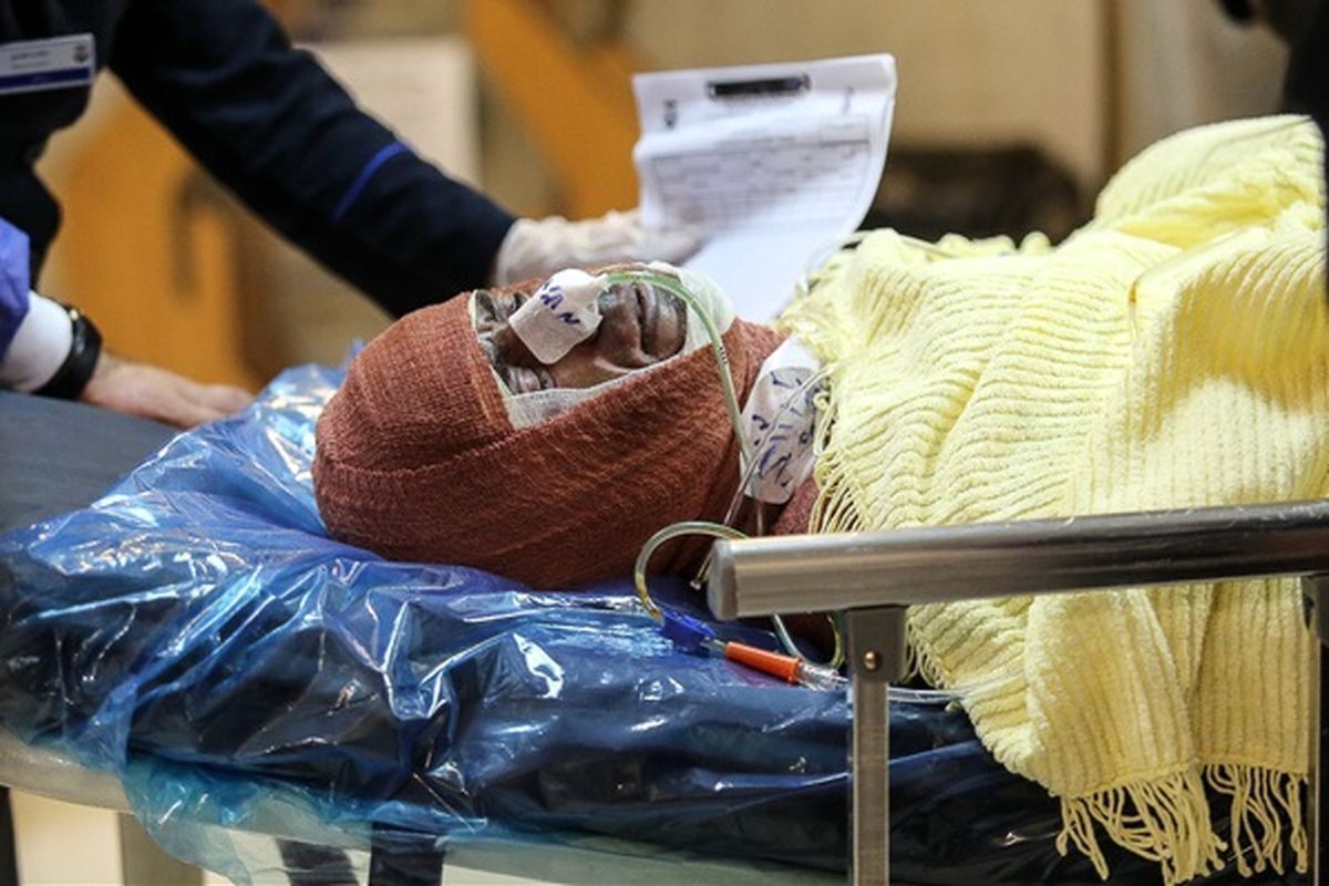 وقوع سالانه ۳۰۰هزار مورد سوختگی/ تخت سوختگی استاندارد دولتی نداریم