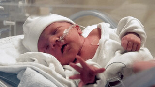 این کودکان برای هر ماه زندگی به ۳۵ میلیون تومان نیاز دارند