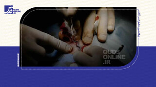 فیلم | بررسی زخم‌های کشته‌شدگان اغتشاشات توسط یک کارشناس اسلحه