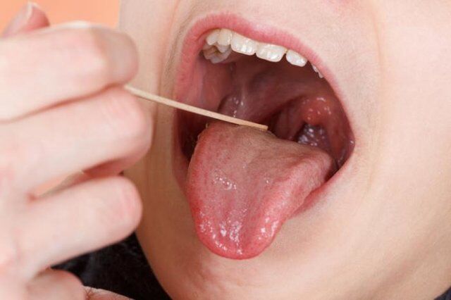 نقش لوزه‌ها در سیستم ایمنی بدن چیست؟