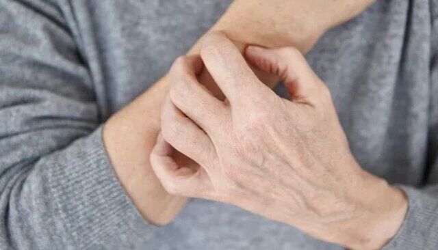 خطاهای رایج پوستی در هوای سرد