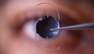 سبک زندگی نادرست، سن ابتلا به آب‌مروارید را پایین آورد/ این بیماری با قطره و عینک درمان نمی‌شود