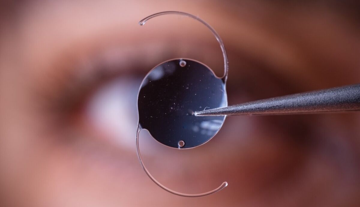 سبک زندگی نادرست، سن ابتلا به آب‌مروارید را پایین آورد/ این بیماری با قطره و عینک درمان نمی‌شود