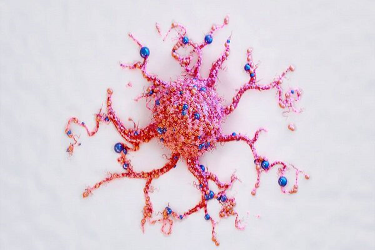 تشخیص سرطان در خانه با تست ادرار!