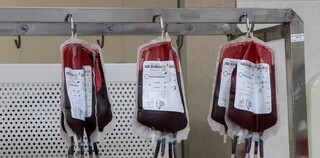 بررسی کیفیت خون اهدایی در عرض تنها ۲ دقیقه