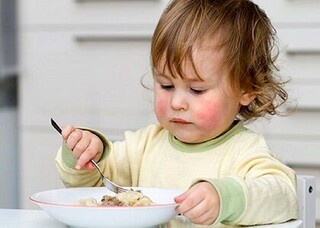 دلایل حساسیت های غذایی در کودکان