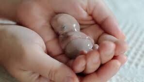 هشدار نسبت به "صنعت سقط غیرقانونی"/ ضرورت حمایت فوری از مادران دارای بارداری ناخواسته