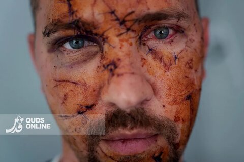 چهار سال جنگ اوکراین