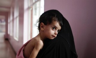معاون وزیر تعاون، کار و رفاه اجتماعی خبر داد/ ۱۸۸ هزار کودک مبتلا به سوءتغذیه اعتبار خرید سبدغذایی رایگان گرفتند